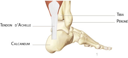 cheville achille
