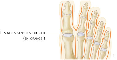 pied syndrome morton